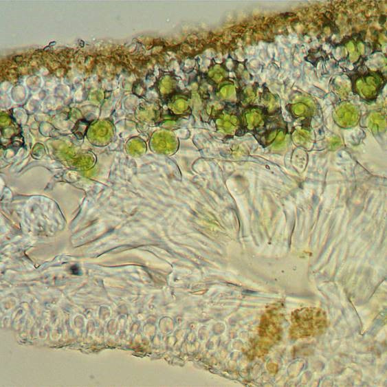 A thin section of a lobe of Xanthoria parietinaP