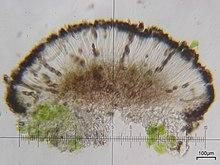 Section through an apothecium of Amandinea punctata