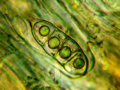Spores in ascus - Collema bachmanniana © Paul L. Smith