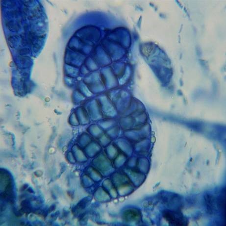 Eight ascospores of Polyblastia dermatodes