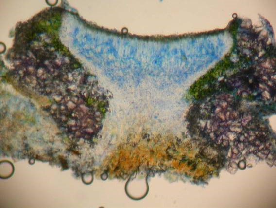 Section of Lecanora chlarotera after N/ink-vinegar staining