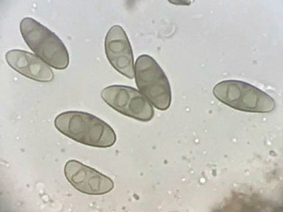 Rinodina exigua spores, Moccas 2018