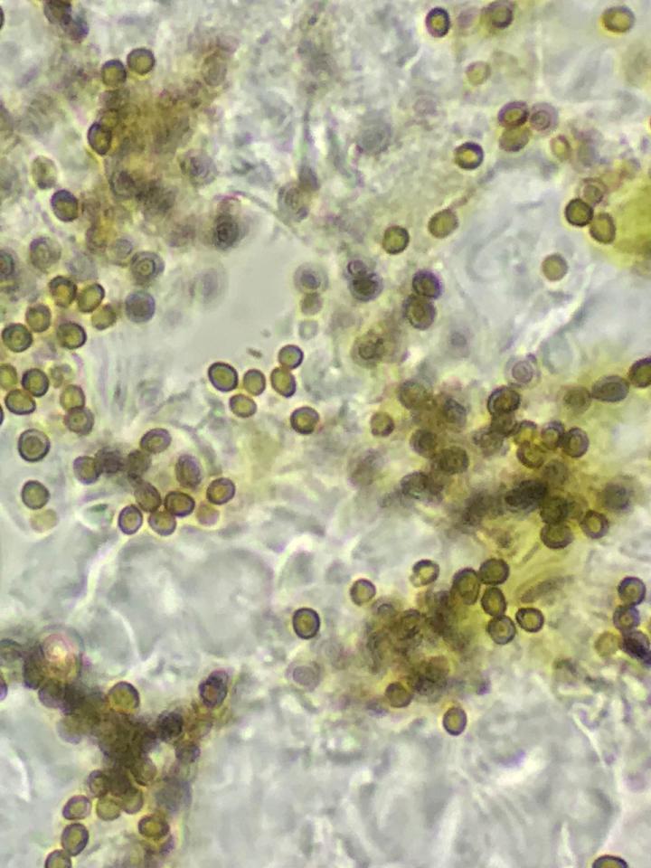 Lichenoconium pyxidatae, conidia