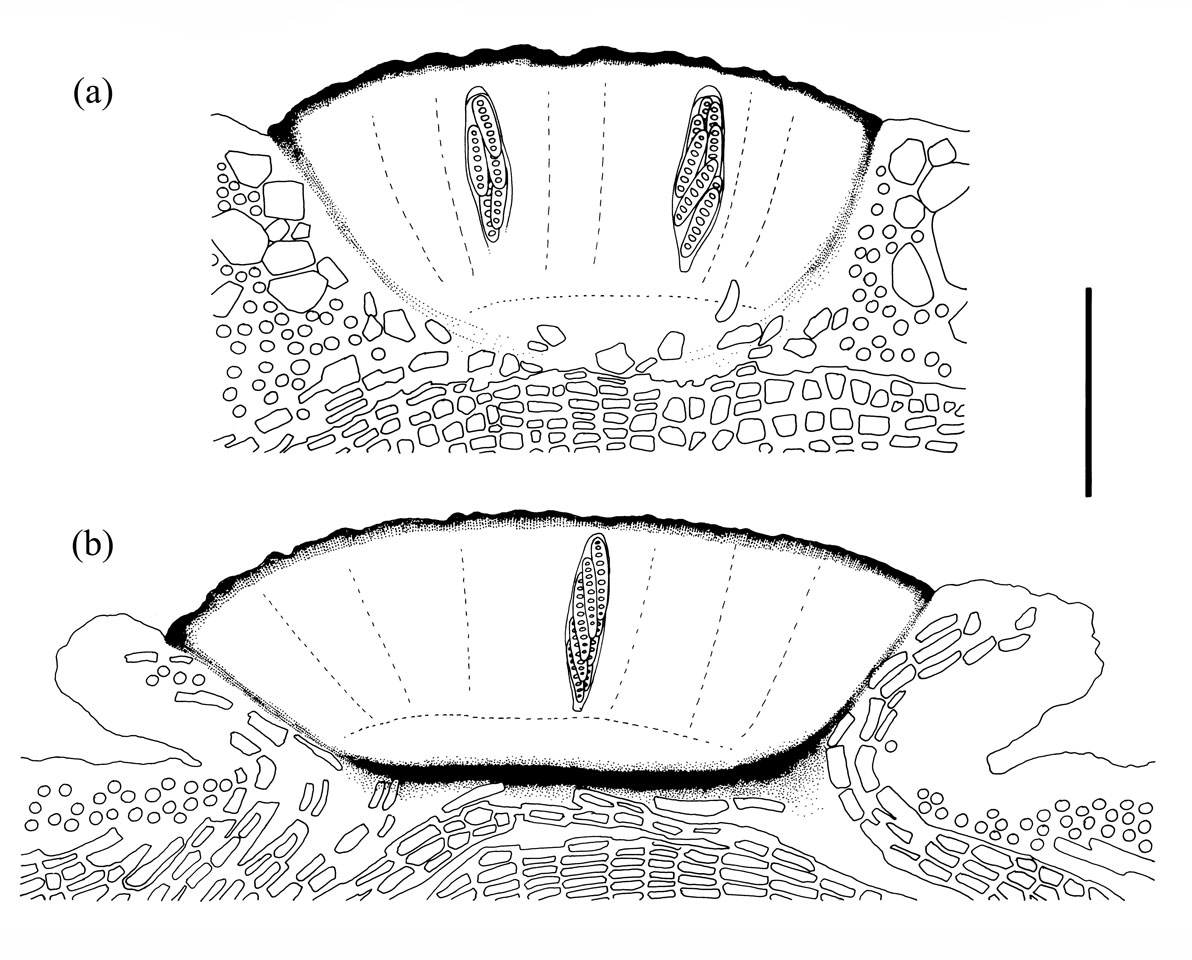  Phaeographis apothecial sections. (a) P. smithii; (b) P. dendritica. Scale bar = 100 μm