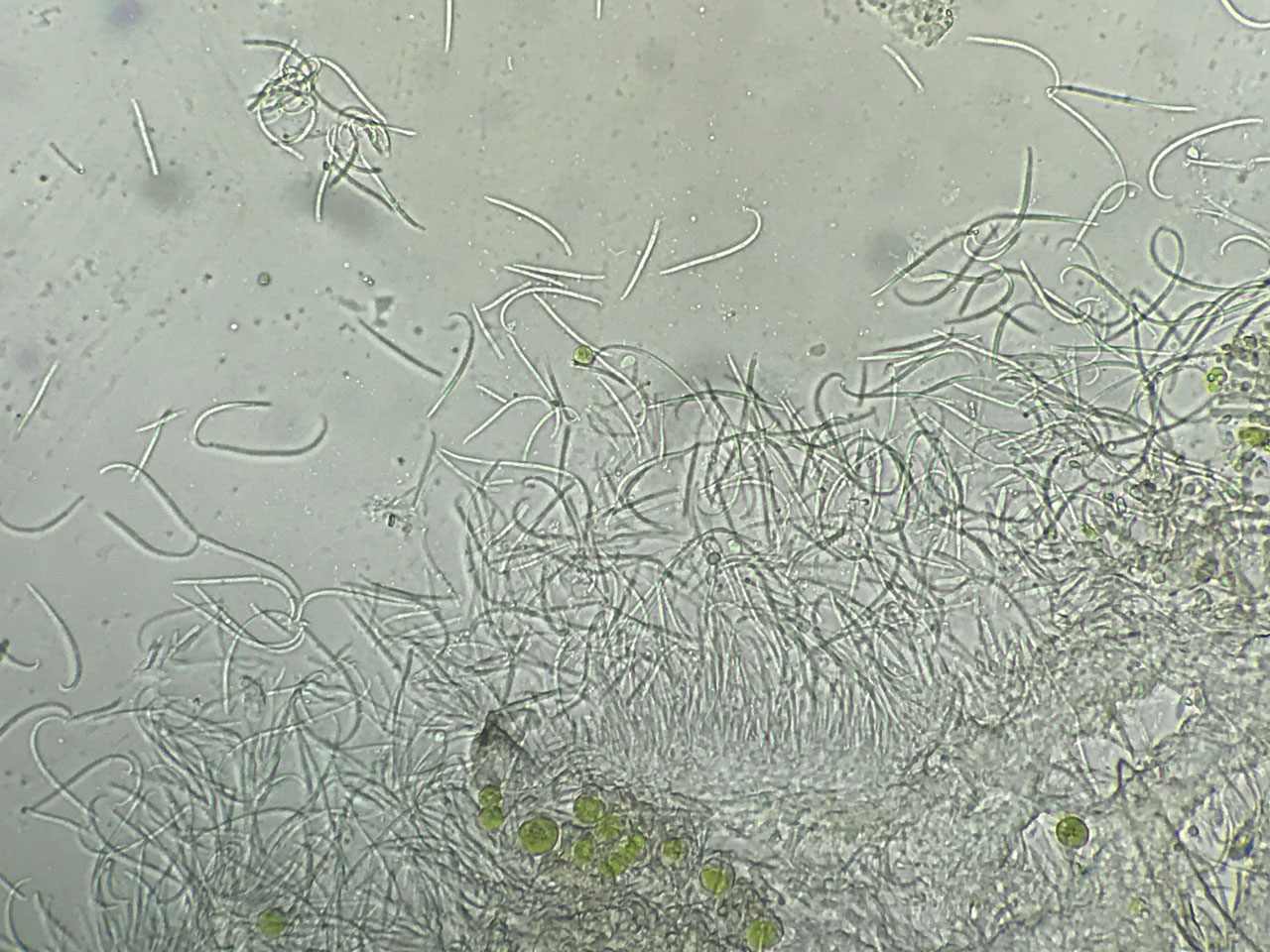 Bacidina celtica (Bacidina squamellosa), conidia, Sallow, Sticknage Wood, New Forest