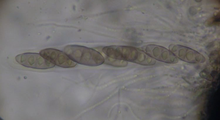 Pyrenula macrospora, ascus with spores, on Sycamore,  Ballygrant, Islay
